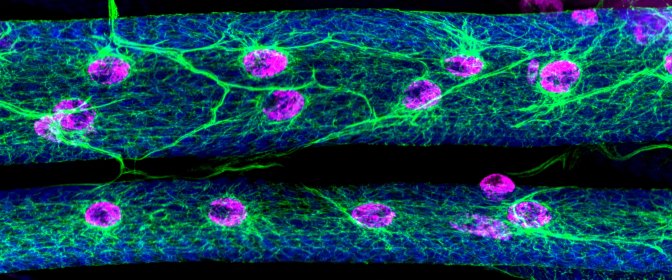 Two muscles in a late stage Drosophila larva stained for the sarcomeres (blue), nuclei (magenta), and microtubules (green).